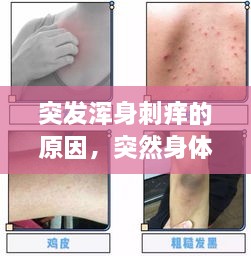 突发浑身刺痒的原因，突然身体刺痒 