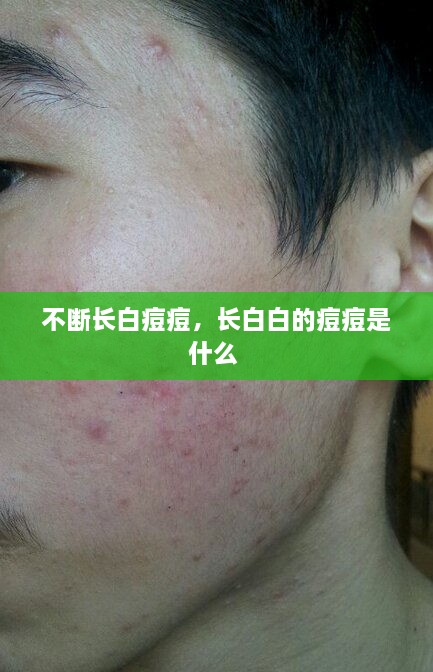 还淳反素
