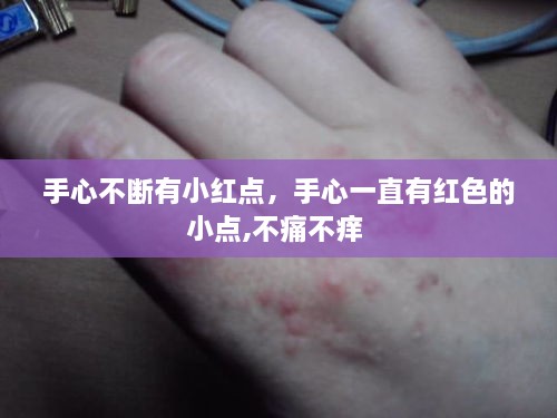 手心不断有小红点，手心一直有红色的小点,不痛不痒 