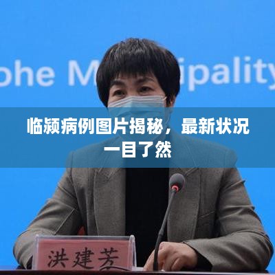临颍病例图片揭秘，最新状况一目了然